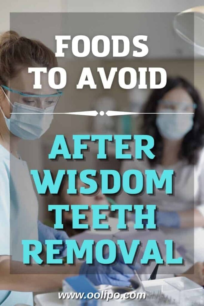 Foods to Avoid After Wisdom Teeth Removal