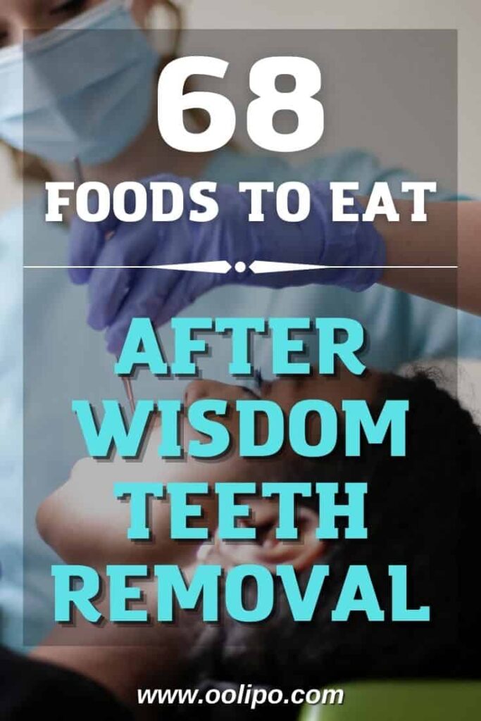 68 Foods You Can Safely Eat After Wisdom Teeth Removal