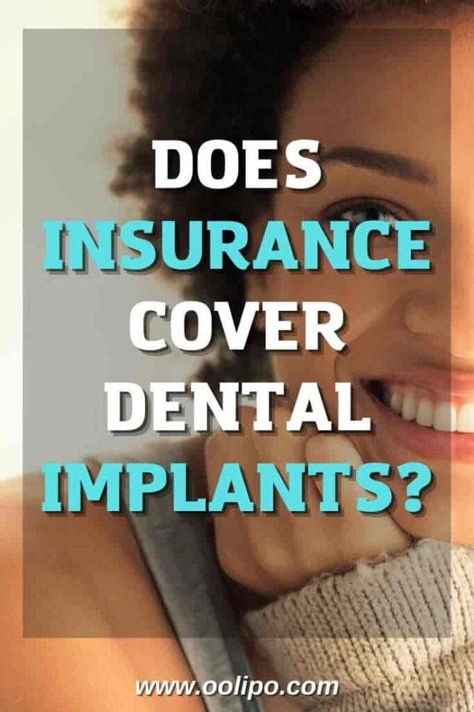 Does Insurance Cover Dental Implants?