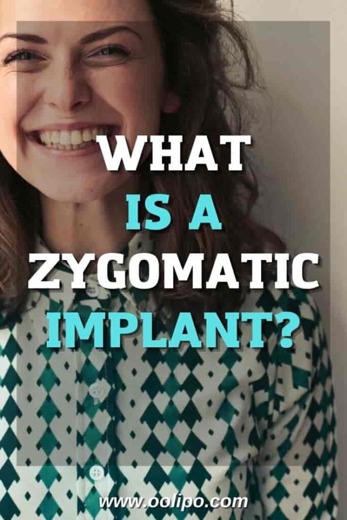 Zygomatic Implants