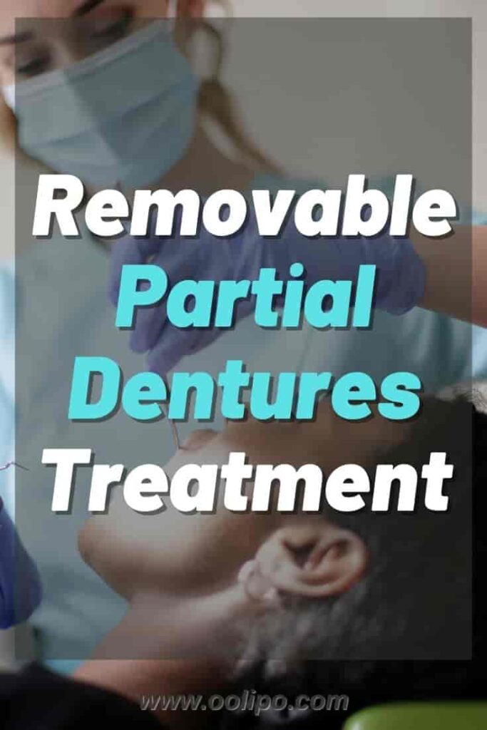 Removable Partial Dentures Treatment