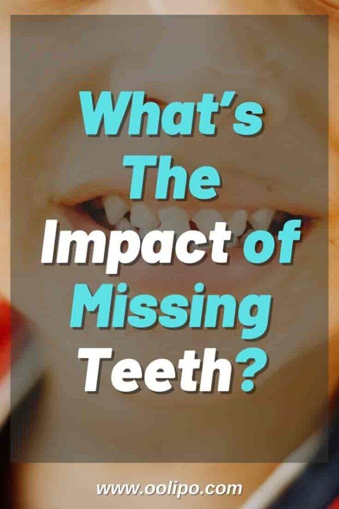 What’s The Impact of Missing Teeth?