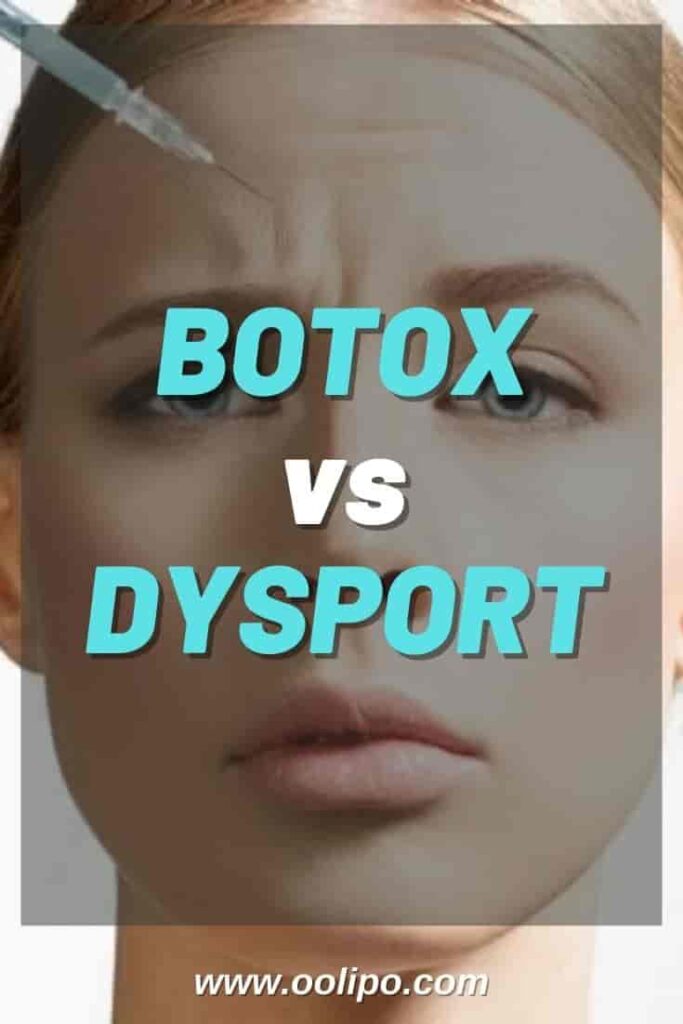 Botox vs Dysport