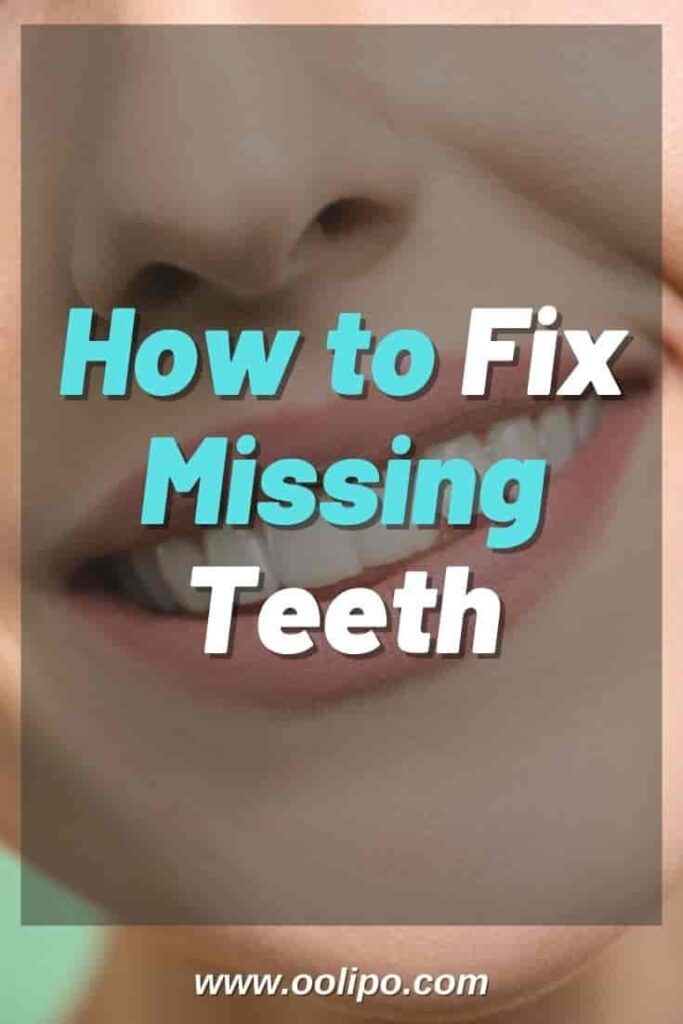 How to Fix Missing Teeth? 